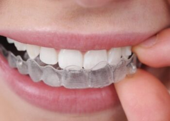 How Much Do Clear Aligners Cost?