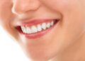 What Are The Benefits of Professional Teeth Whitening?