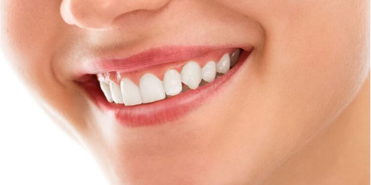 What Are The Benefits of Professional Teeth Whitening?