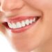 What Are The Benefits of Professional Teeth Whitening?