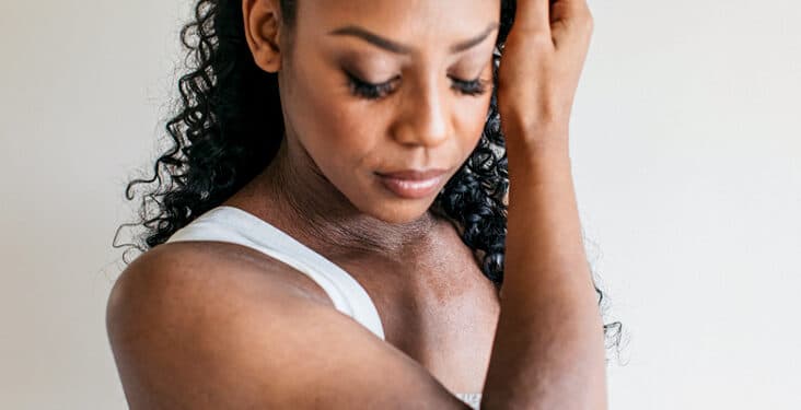 How to Use Loma lux Eczema Pill